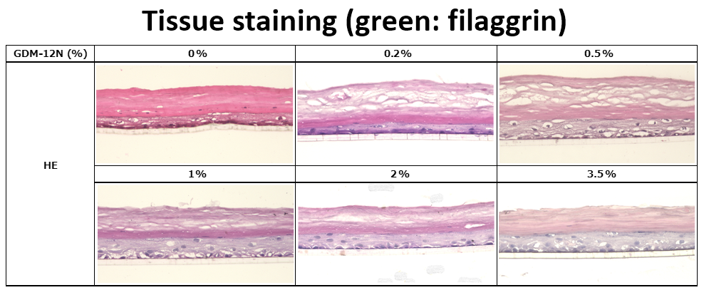 Tissue staining (green: filaggrin)「HE」