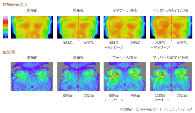 QuSome®ヒートアイコンプレックスとマッサージ併用での皮膚表面温度および血流量に及ぼす効果の検討