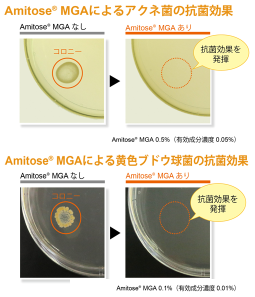 アミトース®MGA