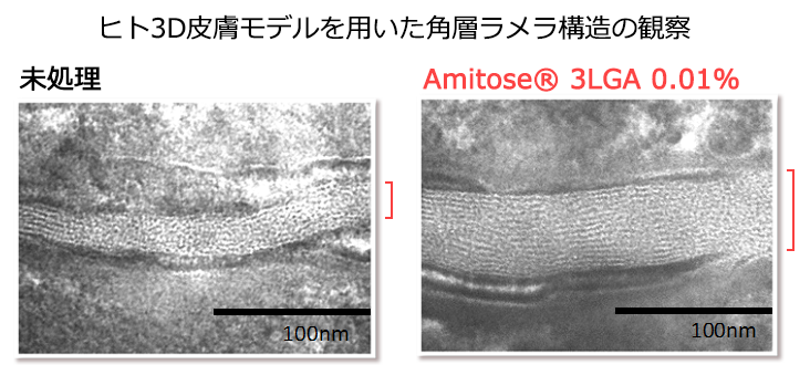 アミトース®3LGA