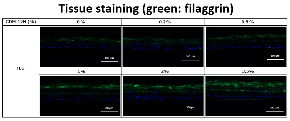 Tissue staining (green: filaggrin)「FLG」
