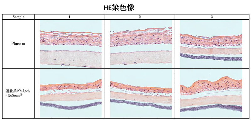 Table 1　HE染色像