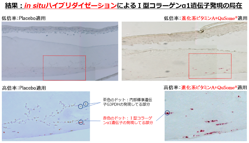 Ⅰ型コラーゲンα1遺伝子発現亢進